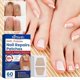 thumbnail image 2 of 60pcs Toenail Fungus Treatment Stickers Ingrowning Toenail Nail Repair Patch, 2 of 5