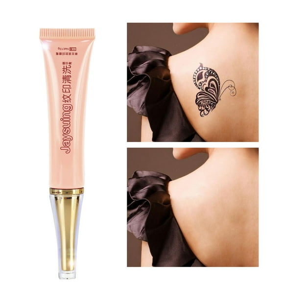 Tattoo Removal Tattoo Removal