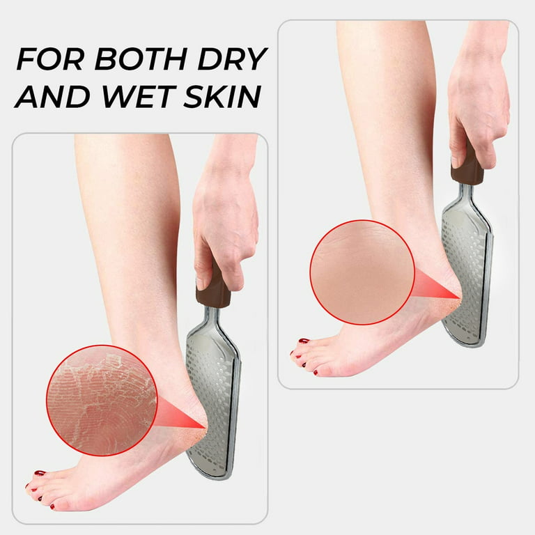 Colossal Foot Rasp Foot Files and Callus Hard Skin Remover Feet
