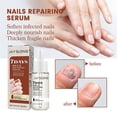 thumbnail image 2 of 2PCS Nail Repair Serum Fungal Nail Treatment Liquid Remove Onychomycosis Toe Essence, 2 of 5