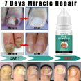 thumbnail image 3 of Tratamiento de uñas AFeng 10ml, 3 of 5