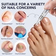 thumbnail image 2 of Antifungal Nail Treatment Pen(10PCS), Extra Strength Toenail Fungus Treatment for Toenails & Fingernails, 2 of 8