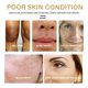 thumbnail image 2 of Dimollaure-crema facial blanqueadora para pecas, elimina el Melasma, manchas oscuras, pigmento de melanina, hidratante, ilumina, crema de día, cuidado de la piel"1pcs" Fivean LED, 2 of 2