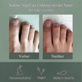 thumbnail image 5 of Intensive Nail Fungus Treatment Pen, Quick Repair Care for Healthy Nails, 5 of 5