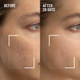 thumbnail image 2 of Exfoliante facial Dr. Brandt, microdermoabrasión, 60 g, paquete de 2, 2 of 9