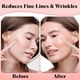 thumbnail image 2 of Maquinillas de afeitar Dermaplaning Tool Kitsch Dermaplaner, 12 unidades, 2 of 3