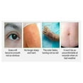 thumbnail image 3 of 2 Pack Kelo-cotee Advanced Formula Gel Sinclair For Scars Removal Treatment-4PCS-, 3 of 5