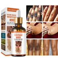 thumbnail image 1 of Dark Knuckle Whitening Serum Hand Elbow Knee Brightening Serum Skin Moisturizer, 1 of 3