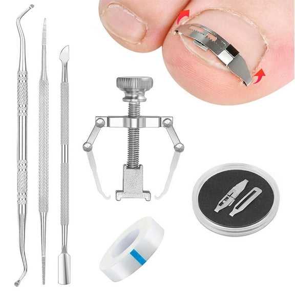 Paronychia Toe Nail Corrector Ingrown Toenail Straightening Correction