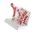 thumbnail image 1 of 1:1 Human Lumbar Vertebra Thighbone Osteoporosis Pathology Model Kit, 1 of 9