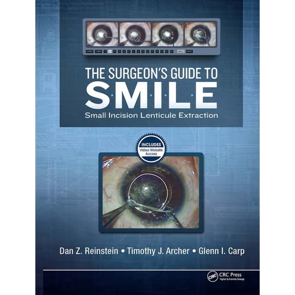 The Surgeon's Guide to SMILE: Small Incision Lenticule Extraction, (Hardcover)