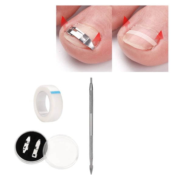 Ingrown Toenail Correction Kit, 3 Pieces - Nail Correction Sticker Patch, Physical Stretching Nail Treatment Tool, Foot Masks Easter Mother'S Day Stainless Steel Makeup Organizers