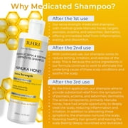 Psoriasis Shampoo with Manuka Honey | Best Itchy Scalp Treatment for Eczema