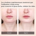 thumbnail image 3 of Dispositivo antiarrugas facial, dispositivo de belleza, dispositivo de belleza para el cuidado de la piel con masaje facial EMS, reafirmante facial y lifting de cuello (45), 3 of 5