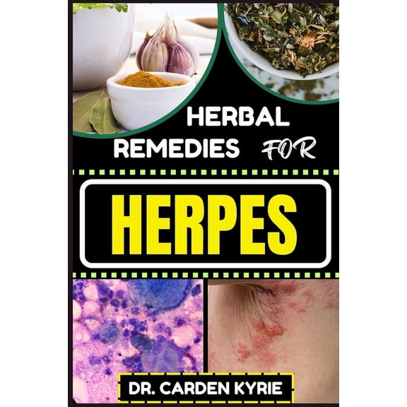 Herbal Remedies for Herpes: Unlocking Nature's Healing Power For Targeting Relief, Holistic Wellness, Immune Support And, (Paperback)