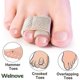 thumbnail image 3 of 6-pack Of Hammer Toe Straighteners For Straightening Hammer Toes, Broken Toes, Crooked Toes And Overlapping Toes Tw, 3 of 5