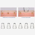 thumbnail image 3 of USB Électrique Points Noirs Élimination Vide Visage Pores Nettoyant Exfoliant Levage Raffermissant Machine, 3 of 8