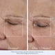 thumbnail image 5 of Crema hidratante facial Obagi ElastiDerm Lift Up & Sculpt 50 ml, 5 of 9