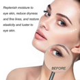 thumbnail image 2 of Parche humectante, Eelhoe Moisturizing Eye Mug Fades Eye Pattern Anti-Wrinkle Anti-Aging Tightening And Hydrating Eye Periocular Skin - 10 pares,, 2 of 4