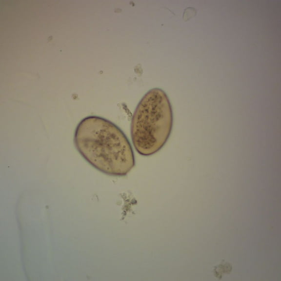 Fasciola Hepatica Eggs Slide, W.M.