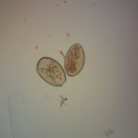 Fasciola Hepatica Eggs Slide  W.M. price history on PriceWatchPro