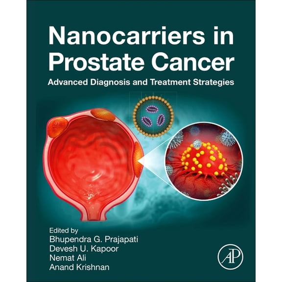 Nanocarriers in Prostate Cancer: Advanced Diagnosis and Treatment Strategies, (Paperback)