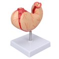 thumbnail image 2 of Yazoeia Human Stomach Model Simulated Stomach Anatomy Model Display Props for School Classroom Hospital Study MR318-3776, 2 of 13