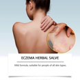thumbnail image 3 of 1-3x Eczema Herbal Salve, Targeted Relief with Natural Botanicals, Moisturizing & Gentle, Relieves Pruritus And Redness, Mild And Non-Irritating, 3 of 5