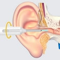 thumbnail image 2 of Temperature Control Ear Scoop Gentle And Sensitive Ear Care And Can Be black, 2 of 6