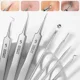 thumbnail image 4 of Pinzas para quitar puntos negros, ultrafinas, de 5 celdas, para salón de belleza, salud facial, herramienta especial para eliminar puntos negros y acné, 4 of 5