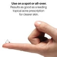 thumbnail image 3 of Anti-blemish Solutions Clinical Clearing Gel --30ml-1oz, 3 of 5