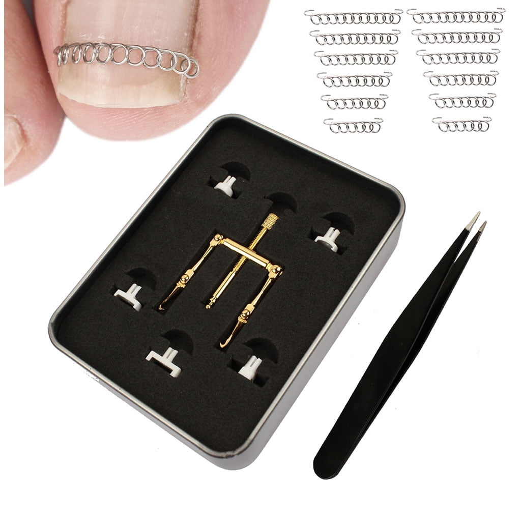 JULYING Ingrown Pincer Paronychia Toe Nail Straightening Correction