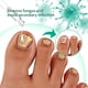 thumbnail image 4 of Aceite Para Hongos En Las Uñas De Los Pies, Líquido Fácil De Aplicar Para Eliminar Hongos En Las Uñas, Suave Para El Cuidado De Las Uñas, 4 of 8