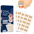 thumbnail image 1 of Tratamiento de uñas encarnadas, 50 piezas, parche corrector transpirable sin pegamento, corrector de uñas encarnadas sin dolor, herramienta de tratamiento de uñas encarnadas de reparación rá, 1 of 5