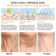thumbnail image 4 of Tratamiento integral para la piel Cream Flysmus Bee Venom de 50 ml, 4 of 7