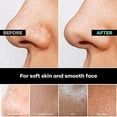 thumbnail image 5 of Dermasuri Exfoliating Face Scrubber, Facial Cleansing and Dead Skin Remover for Women & Men (1 Pack), 5 of 8