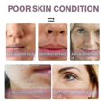 thumbnail image 4 of Eelhoe Collagen Anti Wrinkle Serum Anti-aging Ceramide Procollagen Boosting Ampoule-M, 4 of 5