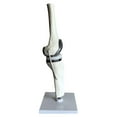 thumbnail image 4 of Knee Joint Model Simulation Replacement Surgery Meniscus Ligament Cartilages Model,Artificial, 4 of 6