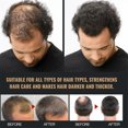 thumbnail image 2 of Shampooing Anti-Calvitie Nourrissant pour la Régénération des Cheveux pour Renforcer l'Activation des Racines des Cheveux, 2 of 5