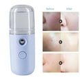 thumbnail image 4 of Rociador facial 30ml Atomizador de niebla de agua para la piel de la cara Rociador portátil humectante para la piel facial, azul claro kenally CE1298-04, 4 of 6