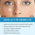 thumbnail image 4 of GlamEssence Skin Removal Quick And Effective Removal Sticker For All Kinds Of Skin Friendly To New User(144pcs), 4 of 8