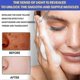 thumbnail image 4 of Niacinamide Facial Cleanser Facial Cleansing Moisturizi, 4 of 5