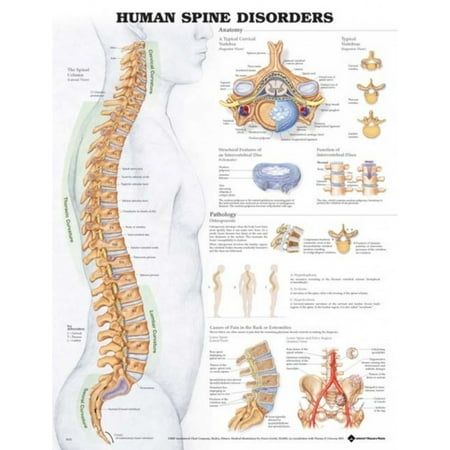 anatomical chart co human spine disorders walmart com anatomical chart co