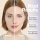thumbnail image 5 of Sérum en gel BALOOM Collagen Booster con masajeadores de microcorriente, 100 ml, 5 of 7