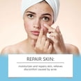 thumbnail image 3 of Delve Deep Into Skin Gently Say Goodbye To Pimples And Regain Smooth Skin Owned Skin Care Products, 3 of 3