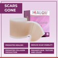 thumbnail image 6 of Medical Grade Silicone Scar Sheets – Non-Irritating Silicone Scar Strips for Surgical Scars,  Tummy Tuck & Keloid Appearance – Soft Gel Scar Sheets, 1.6 in x 60 in, 6 of 7