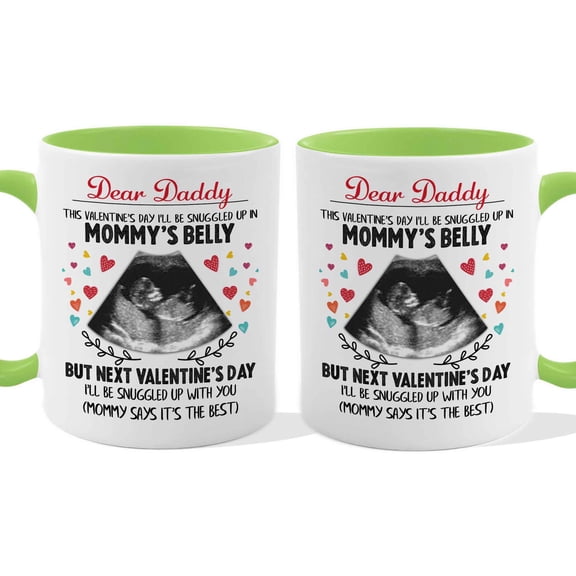 Customizaholic Personalized Pregnancy Announcement Mug - Ultrasound Design, Custom Message Keepsake Gift for Dad