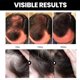 thumbnail image 4 of Patana Hair Essential Oil Makes Hair Smooth, Prevents Hair Loss, Strengthens Hair, Nourishes And Moisturizes Skin Ca, 4 of 4