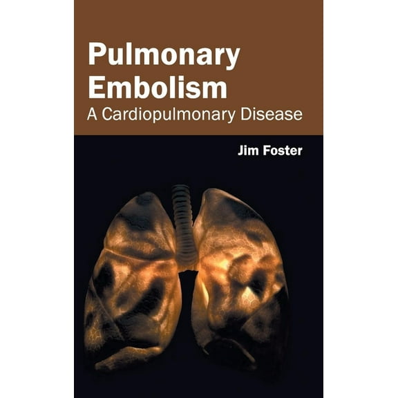 Pulmonary Embolism: A Cardiopulmonary Disease, (Hardcover)