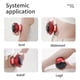 thumbnail image 5 of Smart Cupping Therapy with Red Light, Electric Cellulite Massager for Blood Circulation, Cellulite Reduction & Muscle Relief, 5 of 5